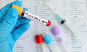 Pakistan tops world in hepatitis C cases: PM’s aide